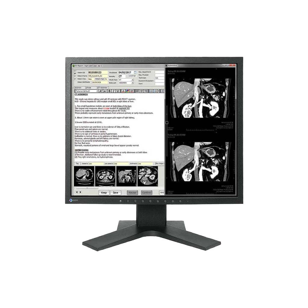 MX194: จอมอนิเตอร์ทางการแพทย์ 19 นิ้ว DICOM Calibration สำหรับภาพวินิจฉัยทางการแพทย์