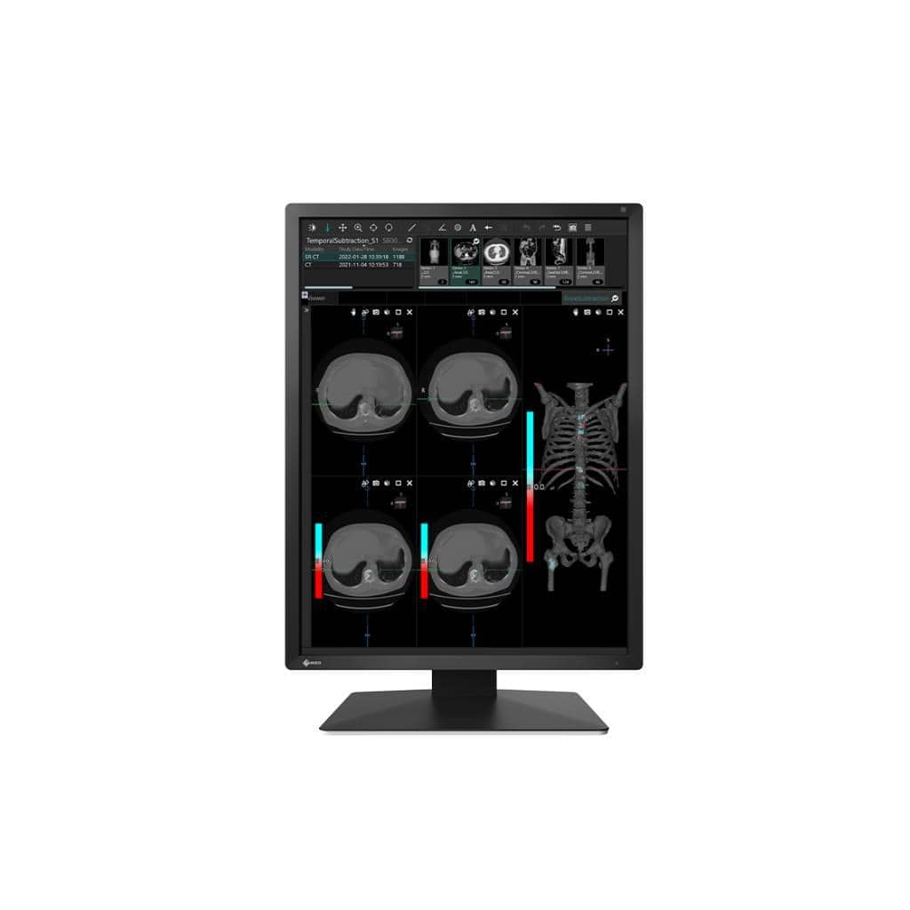 จอภาพทางการแพทย์ AG Neovo MX217: 2MP DICOM พร้อมเซ็นเซอร์แม่นยำสำหรับรังสีวินิจฉัย