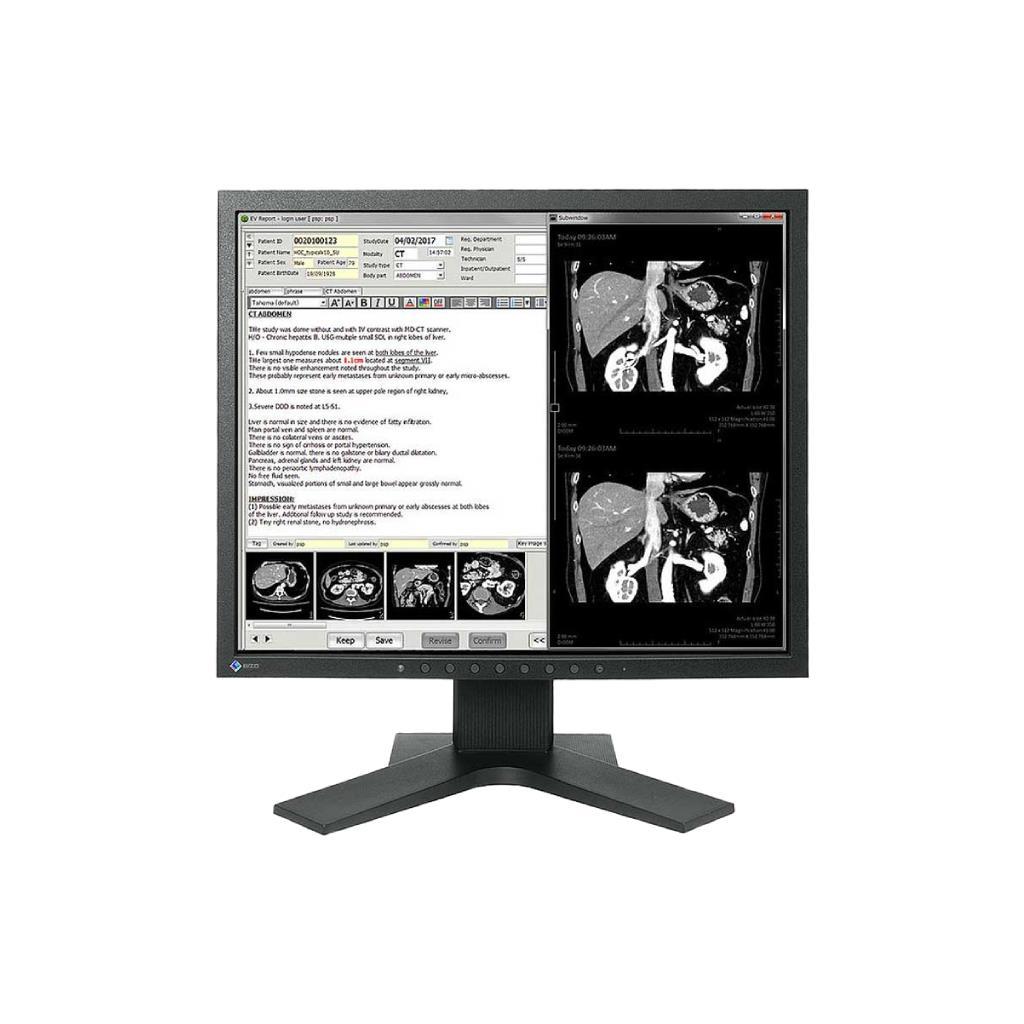 MX194: จอมอนิเตอร์ทางการแพทย์ 19 นิ้ว DICOM Calibration สำหรับภาพวินิจฉัยทางการแพทย์
