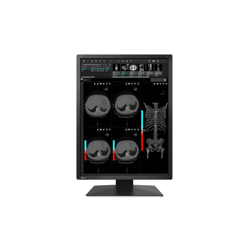 จอภาพทางการแพทย์ AG Neovo MX217: 2MP DICOM พร้อมเซ็นเซอร์แม่นยำสำหรับรังสีวินิจฉัย