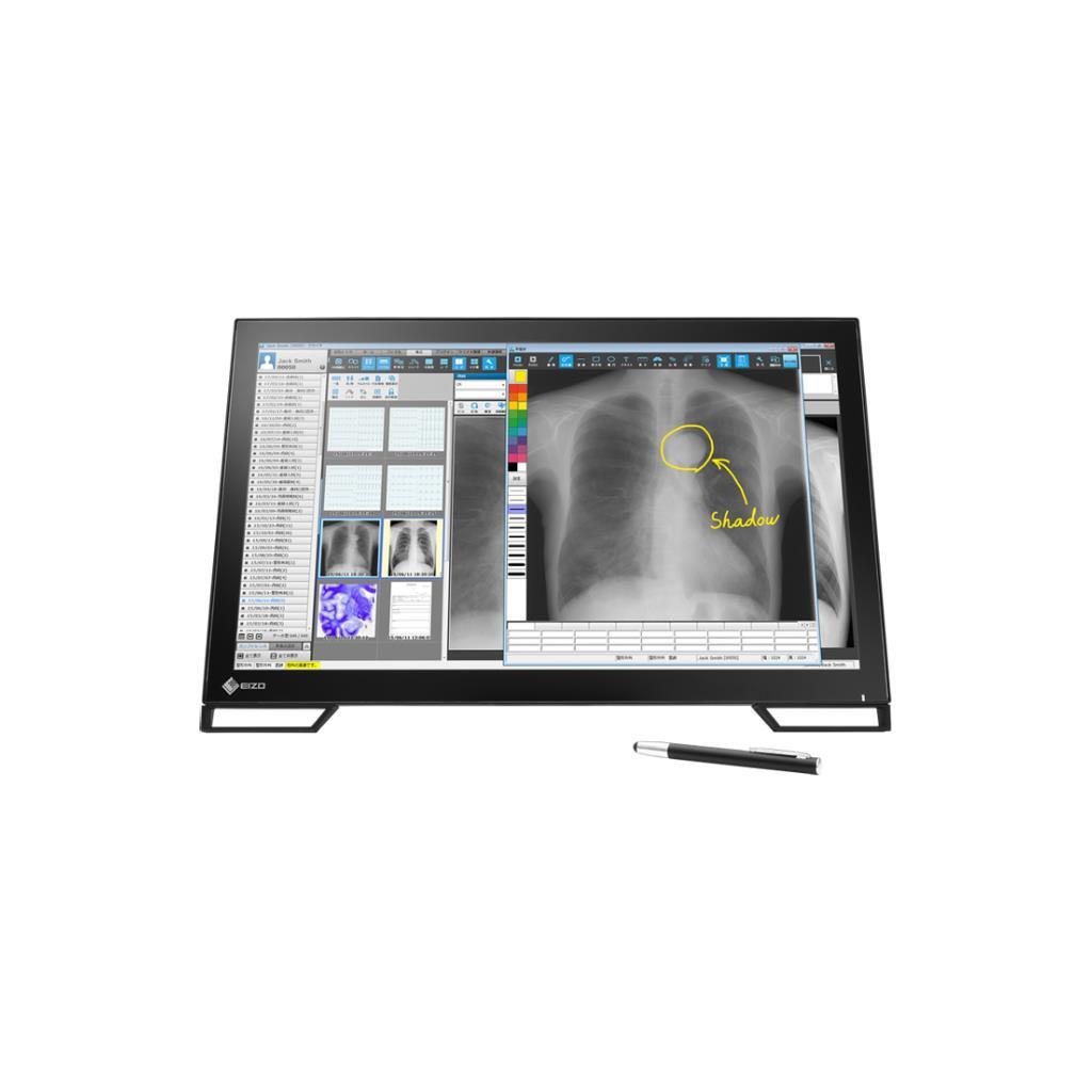 EIZO RadiForce MS236WT-A: จอสัมผัสทางการแพทย์ประสิทธิภาพสูง เพื่อการวินิจฉัยที่แม่นยำ