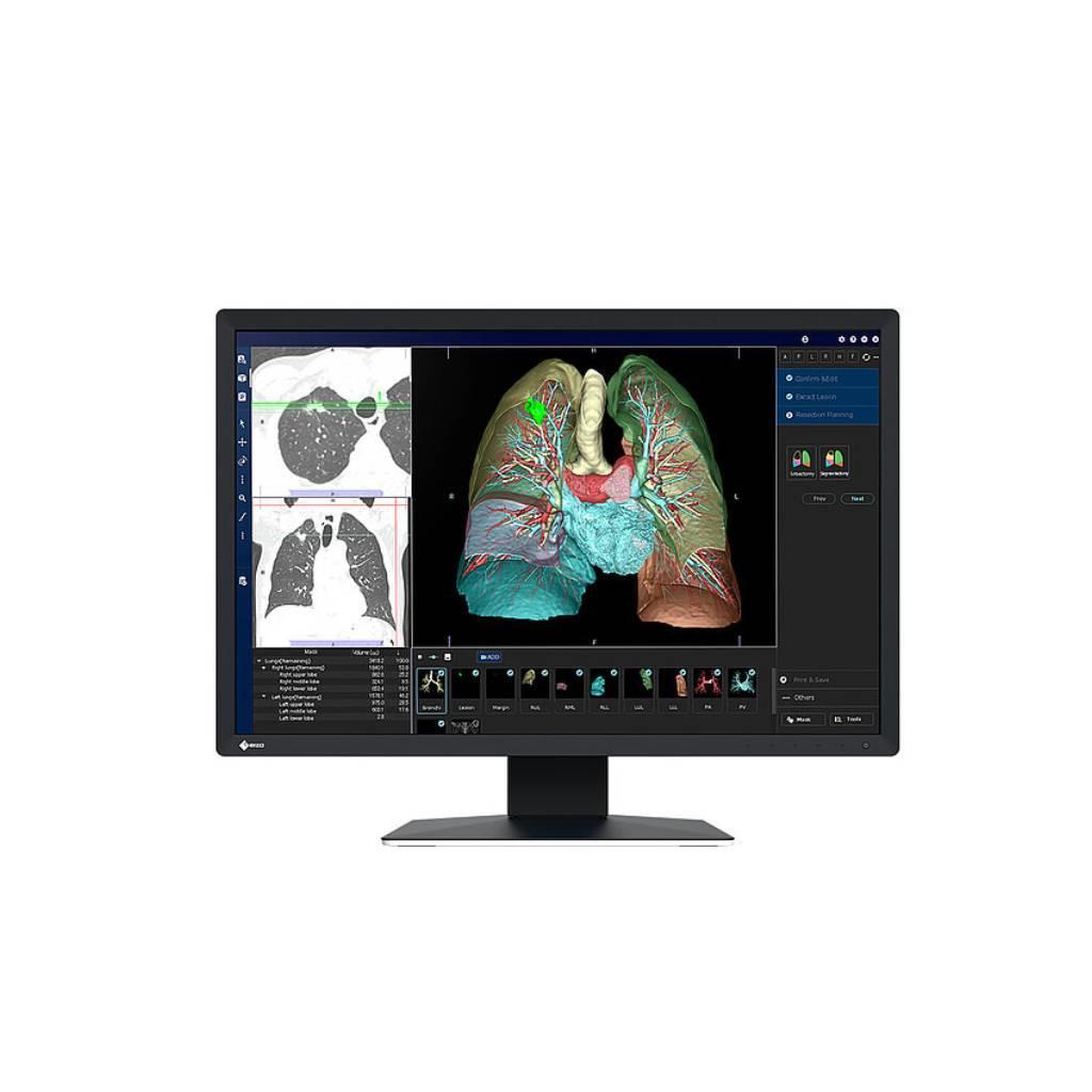 รีวิว EIZO RadiForce MX243W: จอมอนิเตอร์ทางการแพทย์ 2MP IPS 24.1 นิ้ว สำหรับงานวินิจฉัยภาพ