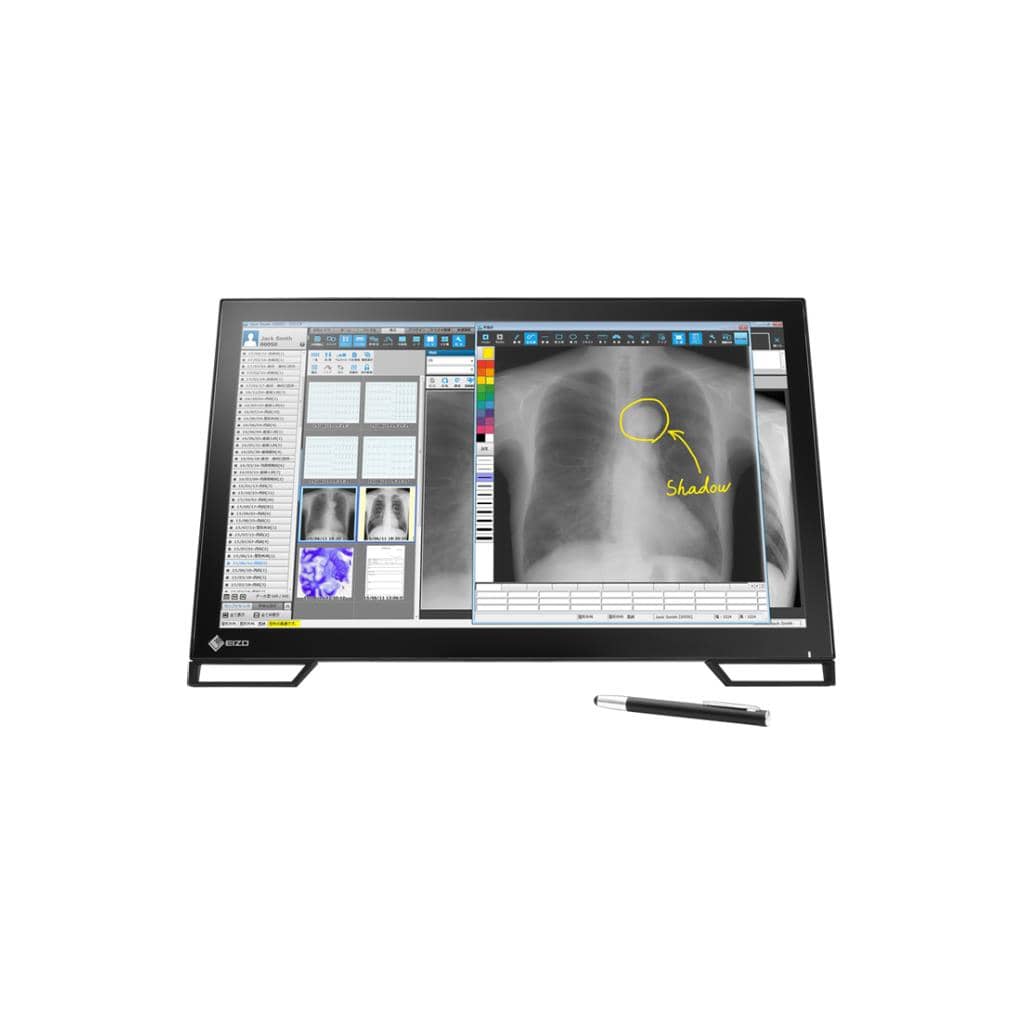 EIZO RadiForce MS236WT-A: จอสัมผัสทางการแพทย์ประสิทธิภาพสูง เพื่อการวินิจฉัยที่แม่นยำ